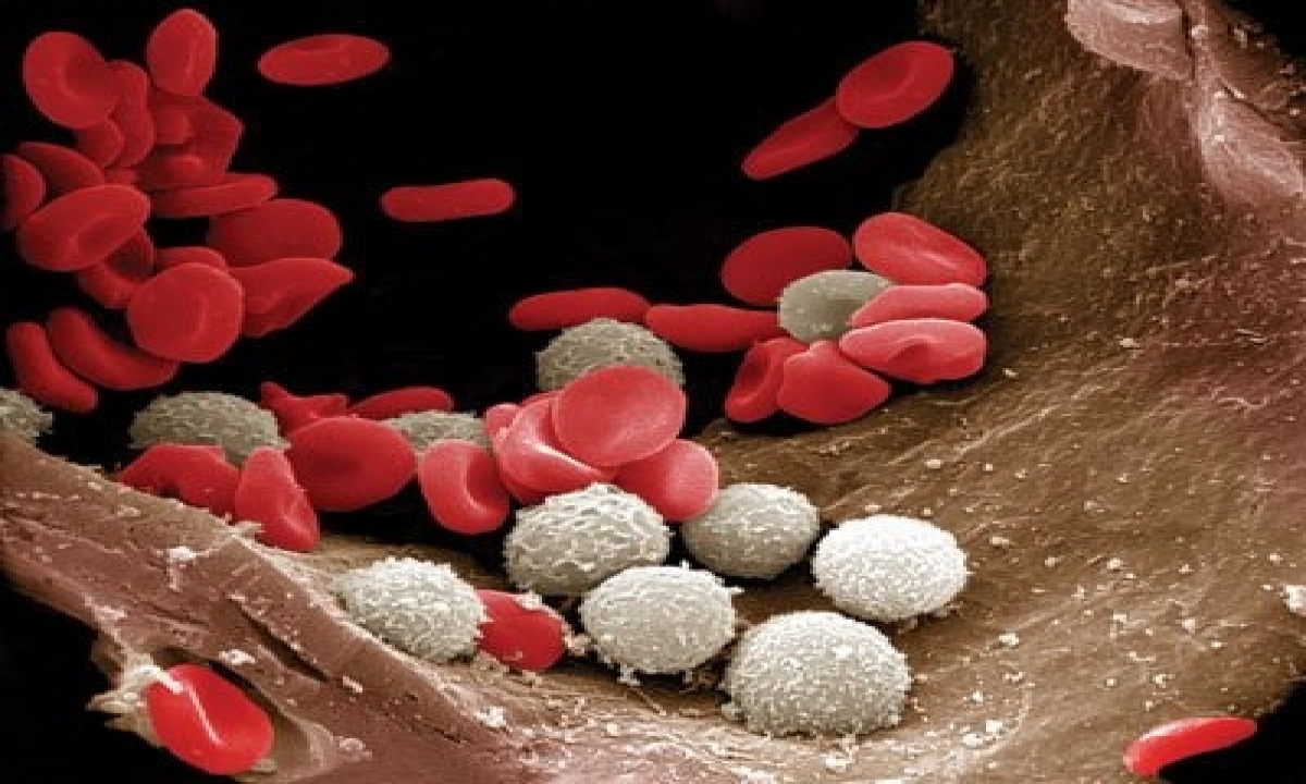  How White Blood Cells Aid In Predicting Covid-19 Severity-TeluguStop.com