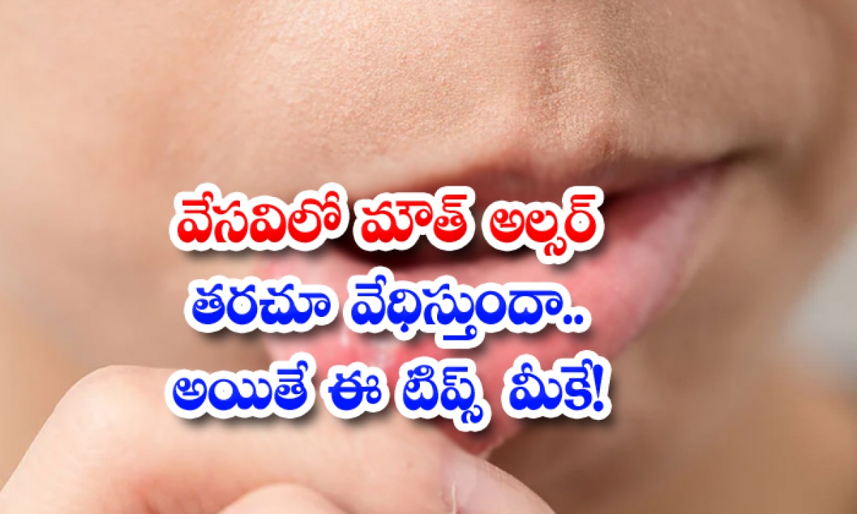  How To Get Rid Of Mouth Ulcers In Summer! Mouth Ulcer, Summer, Summer Tips, Latest News, Health Tips, Good Health, Reduce Mouth Ulcer,-TeluguStop.com