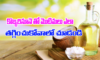  Look How You Can Treat Pimples By Using Coconut Oil-TeluguStop.com