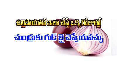  How To Treat Dandruff With Onion Juice-ఉల్లిపాయతో ఇలా చేస్తే ఒక్క రోజులో చుండ్రుకు గుడ్ బై చెప్పేయవచ్చు-Telugu Health-Telugu Tollywood Photo Image-TeluguStop.com