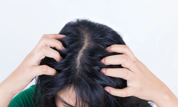 Telugu Beauty, Beauty Tips, Hair Care, Head Itching, Home Remedies, Latest News-Telugu Health - తెలుగు హెల్త్ టిప్స్ ,చిట్కాలు Telugu Beauty, Beauty Tips, Hair Care, Head Itching, Home Remedies, Latest News-Telugu Health - తెలుగు హెల్త్ టిప్స్ ,చిట్కాలు