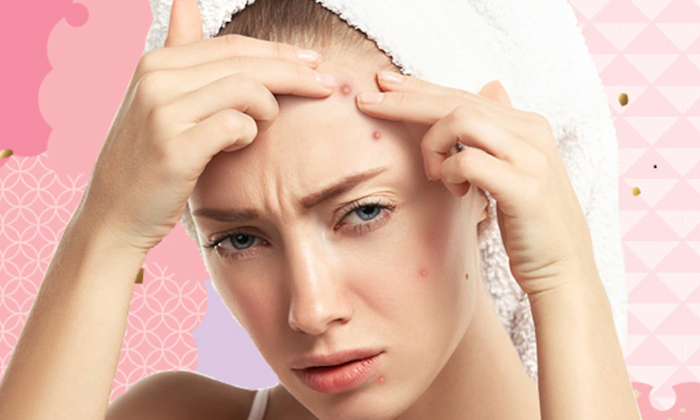 Telugu Beauty, Beauty Tips, Face Care, Face Packs, Latest News, Pimples, Pimples During Periods, Skin Care Tips, Women-Telugu Health - తెలుగు హెల్త్ టిప్స్ ,చిట్కాలు Telugu Beauty, Beauty Tips, Face Care, Face Packs, Latest News, Pimples, Pimples During Periods, Skin Care Tips, Women-Telugu Health - తెలుగు హెల్త్ టిప్స్ ,చిట్కాలు