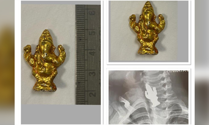 Telugu 3-year-old Boy Swallows 5 Cm Long Ganesha Idol In Bengaluru, Bengaluru, Boy Swallows, Discharged, Endoscopic Operation, Ganesh Idol, Idol, Karnataka, Miraculously, Parenting, Swallows, Vinayaka Idol, Viral News-Latest News - Telugu Telugu 3-year-old Boy Swallows 5 Cm Long Ganesha Idol In Bengaluru, Bengaluru, Boy Swallows, Discharged, Endoscopic Operation, Ganesh Idol, Idol, Karnataka, Miraculously, Parenting, Swallows, Vinayaka Idol, Viral News-Latest News - Telugu
