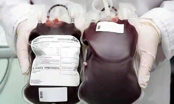 Telugu Aapi Plans Blood Donation Drive In 75 Us Cities, Aapi Premium Healthcare, Association Of Physicians Of Indian Origin, Blood Bank, Independence Of India, Oxygen Concentrators, Ventilators-Telugu NRI Telugu Aapi Plans Blood Donation Drive In 75 Us Cities, Aapi Premium Healthcare, Association Of Physicians Of Indian Origin, Blood Bank, Independence Of India, Oxygen Concentrators, Ventilators-Telugu NRI