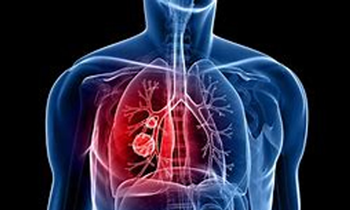 Telugu Cancer, Cigarettes, Do You Smoke Cigarettes On The Run But That\\'s All, Helth Issues, Kidnees Failure, Viral News-Telugu Health Telugu Cancer, Cigarettes, Do You Smoke Cigarettes On The Run But That\\'s All, Helth Issues, Kidnees Failure, Viral News-Telugu Health