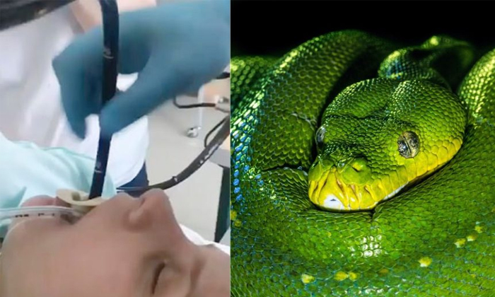 Telugu Dagesthan Area, Doctors Shcoked, Four Feet Snake, Levashi Village, Russia, Snake, Snakes Found In Trroat, Snakes In Throat, Viral News-Latest News - Telugu Telugu Dagesthan Area, Doctors Shcoked, Four Feet Snake, Levashi Village, Russia, Snake, Snakes Found In Trroat, Snakes In Throat, Viral News-Latest News - Telugu