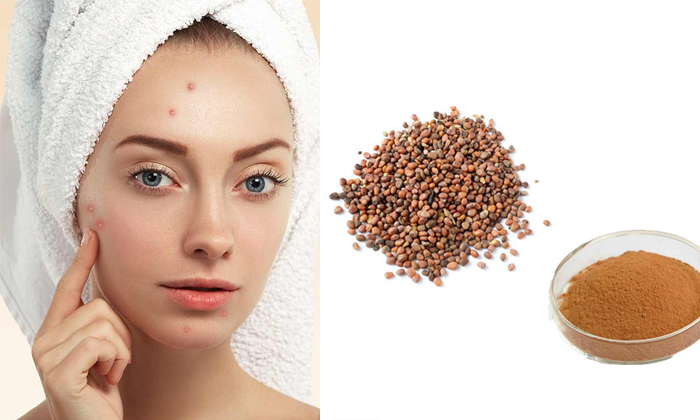 Telugu Beauty, Beauty Tips, Benefits Of Radish Seeds, Pimple Marks, Pimples, Radish Seeds, Radish Seeds For Skin, Reduce Pimple Marks, Skin Care, Skin Care Tips-Telugu Health - తెలుగు హెల్త్ టిప్స్ ,చిట్కాలు Telugu Beauty, Beauty Tips, Benefits Of Radish Seeds, Pimple Marks, Pimples, Radish Seeds, Radish Seeds For Skin, Reduce Pimple Marks, Skin Care, Skin Care Tips-Telugu Health - తెలుగు హెల్త్ టిప్స్ ,చిట్కాలు