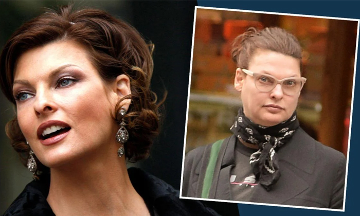 Telugu Canadian Model Linda Evangelista, Canadiyan, Cosmetic Treatment, Fat Removing Surgery, Hollywood, Linda Evangelista, Linda Evangelista Cosmetic Surgery, Super Model, Surgery Gone Wrong-Movie Telugu Canadian Model Linda Evangelista, Canadiyan, Cosmetic Treatment, Fat Removing Surgery, Hollywood, Linda Evangelista, Linda Evangelista Cosmetic Surgery, Super Model, Surgery Gone Wrong-Movie