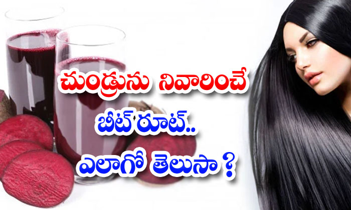  Beetroot Helps To Remove Dandruff Naturally! Beetroot, Dandruff, Latest News, Hair Care, Hair Care Tips, Benefits Of Beetroot, Beetroot For Hair, Hair,-TeluguStop.com