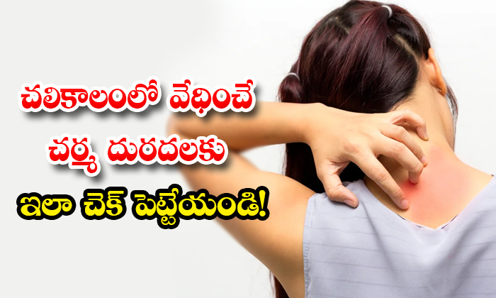  How To Get Rid Of Skin Itching In Winter! Skin Itching, Skin Care, Skin Care Tips, Winter Season, Winter Season Tips, Beauty, Beauty Tips. Itching, Winter Itching, Guava Leaves, Orange Peel, Petroleum Gelly, Olive Oil-TeluguStop.com