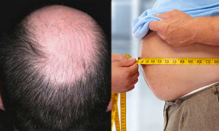 Telugu Bald Head, Breast Cancer, Cholestrol, Diabetese, Diseases, Diseases From Parents, Good Health, Health, Health Tips, Inherit, Latest News, Migrane Head Ache, Parents-Telugu Health Telugu Bald Head, Breast Cancer, Cholestrol, Diabetese, Diseases, Diseases From Parents, Good Health, Health, Health Tips, Inherit, Latest News, Migrane Head Ache, Parents-Telugu Health