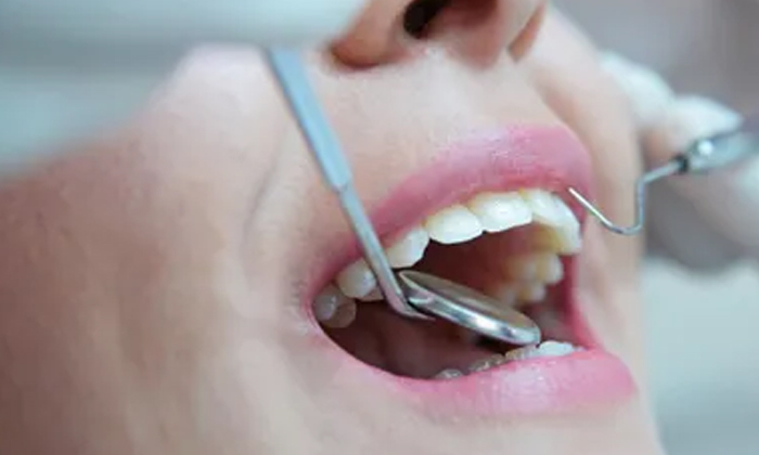 Telugu Bad Foods, Tips, Healthy Teeth, Teeth-Telugu Health - తెలుగు హెల్త్ టిప్స్ ,చిట్కాలు Telugu Bad Foods, Tips, Healthy Teeth, Teeth-Telugu Health - తెలుగు హెల్త్ టిప్స్ ,చిట్కాలు