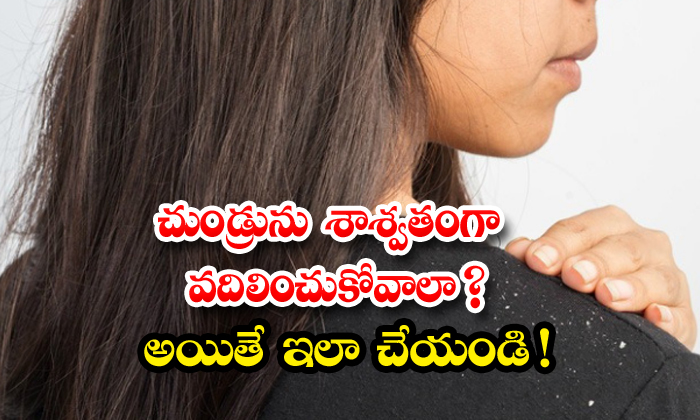  Trying This Effective Remedy Can Get Rid Of Dandruff Permanently! Dandruff, Effective Remedy, Hair, Hair Care, Hair Care Tips, Beauty, Beauty Tips, Home Remedy, Latest News-TeluguStop.com