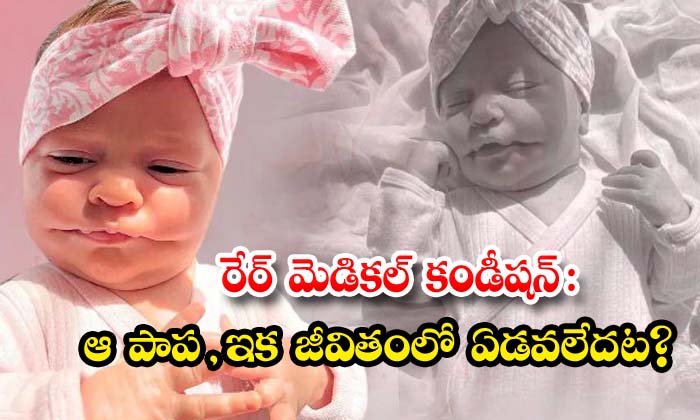  Rare Medical Condition That Baby , Never To Cry Again In Life , Rare Medical, Kid, Australia News, Viral Latest, News Viral, Smiley,social Media ,never To Cry Again In Life-TeluguStop.com