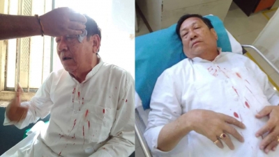  Tripura Cong Chief Among 20 Injured In Clash With Bjp-TeluguStop.com