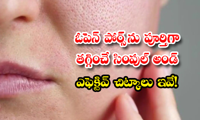  These Are Simple And Effective Tips To Reduce Open Pores Details! Open Pores, Open Pores Treatment, Effective Tips, Home Remedies For Open Pores, Home Remedies, Skin Care, Skin Care Tips, Beauty, Beauty Tips, Latest News, Multhani Mitti, Tomato , Glycerine-TeluguStop.com