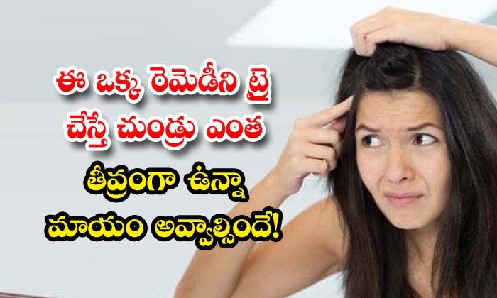  If You Try This One Remedy, Dandruff Will Go Away , Dandruff, Home Remedy, Latest News, Hair Spray, Hair Care, Hair Care Tips, Hair, Healthy Hair-TeluguStop.com