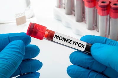  Monkeypox Infections Rise 20% To Over 35k Cases, 12 Deaths: Who-TeluguStop.com