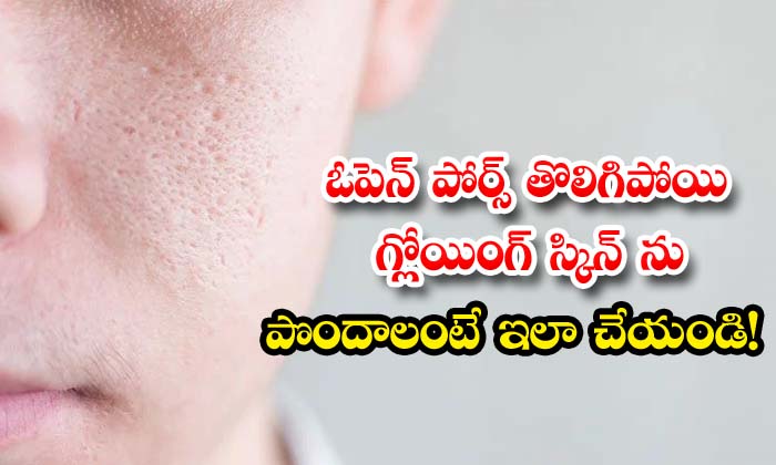  Do This To Get Rid Of Open Pores And Glowing Skin, Open Pores, Pores, Glowing Skin, Skin Care, Skin Care Tips, Latest News, Beauty, Beauty Tips,-TeluguStop.com