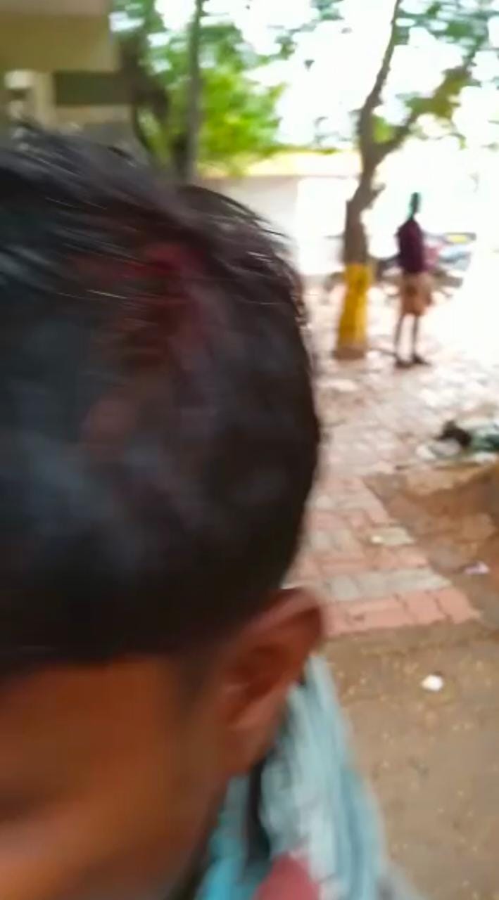  Clash Between Two Communities In Land Dispute In Tirupati District-TeluguStop.com